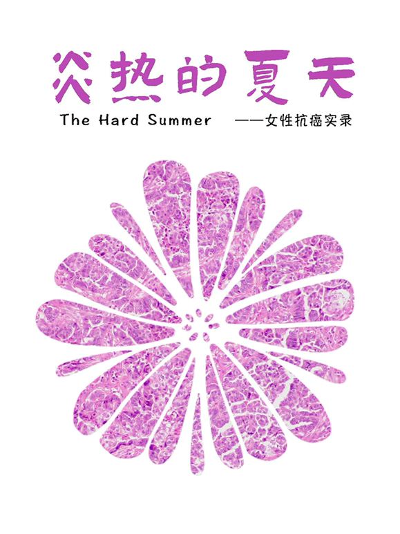 炎热的夏天在线观看